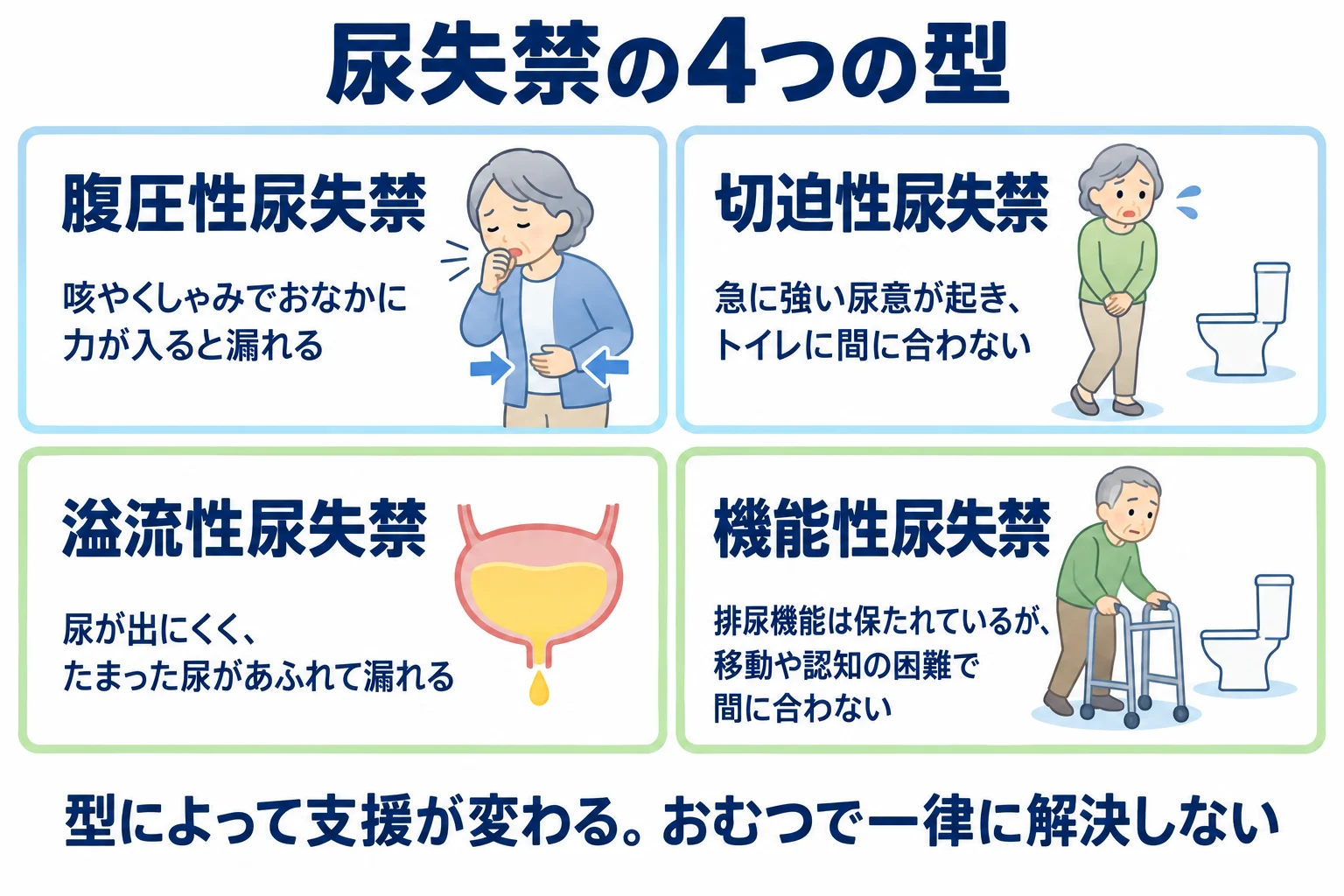 尿失禁の4つの型の図。腹圧性は咳やくしゃみで、切迫性は急な強い尿意で、溢流性はたまった尿があふれて、機能性は移動や認知の困難で漏れる。